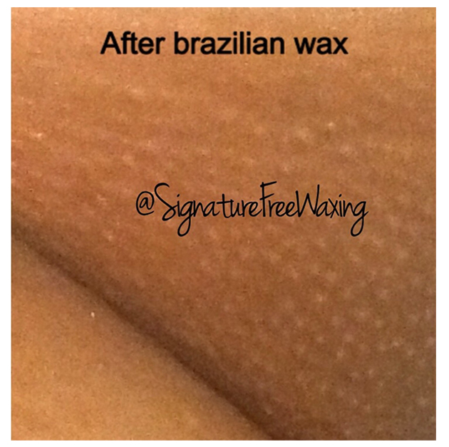 Brazilian Wax